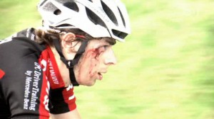 After Tour of Britain Accident